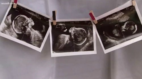 Shocked Dad Faints After Seeing Wifes Abnormal Sonogram Results