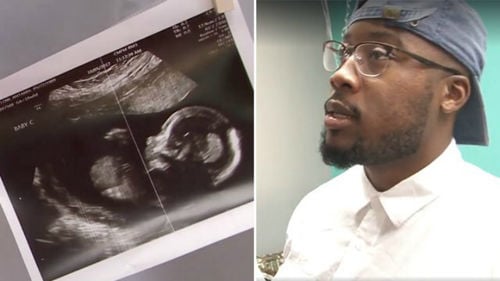Shocked Dad Faints After Seeing Wifes Abnormal Sonogram Results
